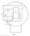 Fig. 02 - Craniofacial external distraction apparatus