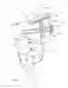 Fig. 02 - Joint fusion implant and methods
