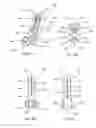Fig. 07 - Joint fusion implant and methods