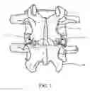 Fig. 02 - Sleeve for bone fixation device