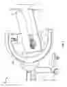 Fig. 06 - Apparatus and methods for fracture repair