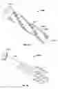 Fig. 40 - Apparatus and methods for fracture repair