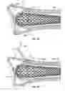 Fig. 43 - Apparatus and methods for fracture repair