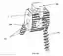 Fig. 19 - Bi-directional fixating/locking transvertebral body screw/intervertebral cage stand-alone constructs with vertical hemi-bracket screw locking mechanism