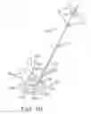 Fig. 09 - Systems and methods for vertebral or other bone structure height restoration and stabilization