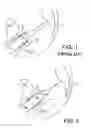 Fig. 02 - Implants and methods for treatments of pelvic conditions