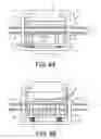 Fig. 07 - Implants and methods for treatments of pelvic conditions
