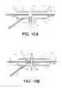Fig. 09 - Implants and methods for treatments of pelvic conditions