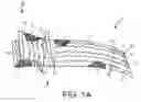 Fig. 02 - Implants and methods for treatments of pelvic conditions