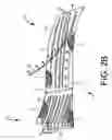 Fig. 07 - Implants and methods for treatments of pelvic conditions