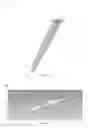 Fig. 02 - Soft Tissue Implant Systems, Kits, Implants, Devices and Associated Methods