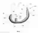 Fig. 03 - Flexible snap-fit prosthetic component