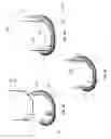 Fig. 05 - Flexible snap-fit prosthetic component