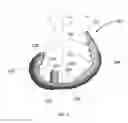 Fig. 06 - Flexible snap-fit prosthetic component