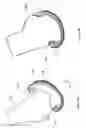 Fig. 12 - Flexible snap-fit prosthetic component