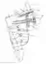 Fig. 01 - Joint fusion instrumentation and methods