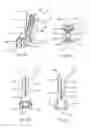 Fig. 07 - Joint fusion instrumentation and methods