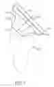 Fig. 08 - Shoulder arthroplasty implant system