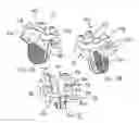 Fig. 07 - A Prosthetic Intervertebral Disc Joint Assembly