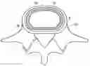 Fig. 01 - In-situ formed intervertebral fusion device and method