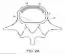Fig. 03 - In-situ formed intervertebral fusion device and method