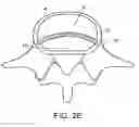 Fig. 07 - In-situ formed intervertebral fusion device and method
