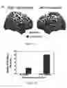 Fig. 09 - Methods and systems for controlling body parts and devices using ipsilateral motor cortex and motor related cortex