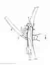 Fig. 07 - Procedures for vascular occlusion