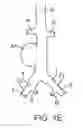 Fig. 03 - Method for manufacturing a personalized prothesis