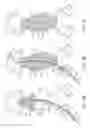Fig. 10 - Method for manufacturing a personalized prothesis