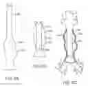 Fig. 11 - Method for manufacturing a personalized prothesis