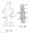 Fig. 16 - Method for manufacturing a personalized prothesis