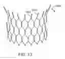 Fig. 23 - Method for manufacturing a personalized prothesis