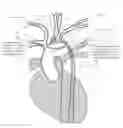 Fig. 01 - Apparatus and method for improved access of procedural catheter in tortuous vessels