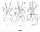Fig. 02 - Apparatus and method for improved access of procedural catheter in tortuous vessels