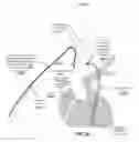 Fig. 28 - Apparatus and method for improved access of procedural catheter in tortuous vessels
