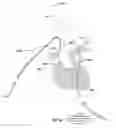 Fig. 33 - Apparatus and method for improved access of procedural catheter in tortuous vessels