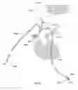 Fig. 40 - Apparatus and method for improved access of procedural catheter in tortuous vessels