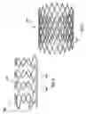 Fig. 06 - STENT-GRAFT DELIVERY SYSTEM HAVING AN INNER SHAFT COMPONENT WITH A LOADING PAD OR COVERING ON A DISTAL SEGMENT THEREOF FOR STENT RETENTION
