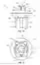 Fig. 09 - Implantable weight control device to promote early and prolonged satiety in a bariatric patient