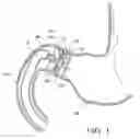 Fig. 02 - Gastrointestinal device