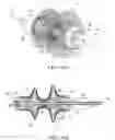 Fig. 07 - Gastrointestinal device
