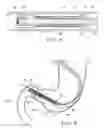 Fig. 09 - Gastrointestinal device