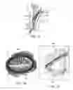 Fig. 02 - Dry eye treatment apparatus and methods