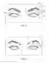 Fig. 07 - Dry eye treatment apparatus and methods