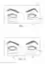 Fig. 09 - Dry eye treatment apparatus and methods