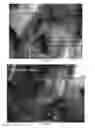 Fig. 09 - Sprayable polymers as adhesion barriers