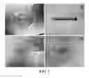 Fig. 02 - COMPOSITION CONTAINING MESENCHYMAL STEM CELL-HYDROGEL AND METHOD FOR PRODUCING THE COMPOSITION