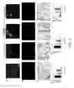 Fig. 07 - METHODS OF TREATING HYPOXIA-ASSOCIATED OPTICAL CONDITIONS WITH CARTILAGE OLIGO MATRIX PROTEIN-ANGIOPOIETIN 1 (COMP-ANG1)