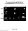 Fig. 13 - METHODS OF TREATING HYPOXIA-ASSOCIATED OPTICAL CONDITIONS WITH CARTILAGE OLIGO MATRIX PROTEIN-ANGIOPOIETIN 1 (COMP-ANG1)